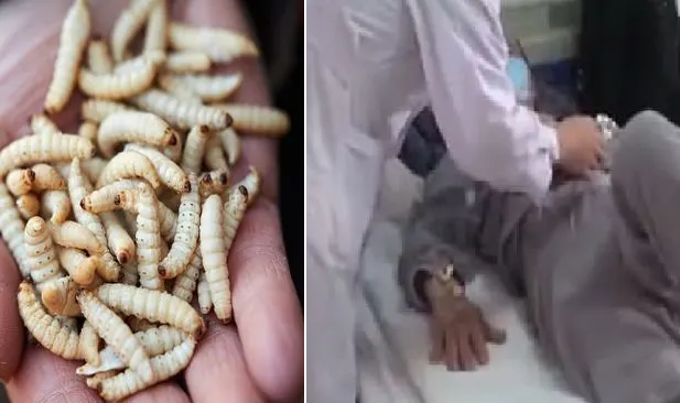 Desperate Woman Eats Bottle Of Live Maggots Heres How That Worked Out